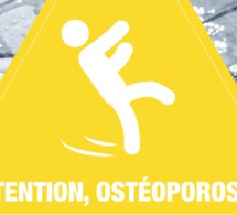 Ostéoporose : une campagne décalée pour sensibiliser à cette maladie osseuse