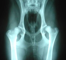 Arthrose et vertiges : l’ostéopathie comme solution durable sans effet secondaire