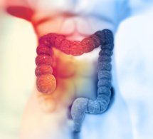 Cancer colorectal : nouvelle campagne d'information à destination des 50-74 ans