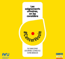 Cancer de la vessie : aussi méconnu que dévastateur