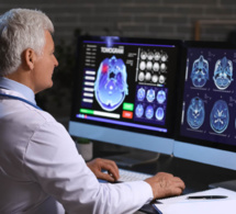 "Maintain Your Brain" : une étude visant à réduire les risques de développer Alzheimer en Australie