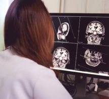 Alzheimer, état des lieux de la recherche scientifique avec le Dr Marion Lévy
