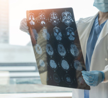 Le point sur les maladies neuro-dégénératives : 2% de la population française est touchée !