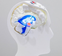 Parkinson : une avancée majeure avec l'implantation d'un dispositif innovant Parkinson : une avancée majeure avec l'implantation d'un dispositif innovant