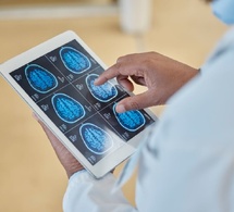 Parkinson : une altération du suivi avec le neurologue avec le temps Parkinson : une altération du suivi avec le neurologue avec le temps