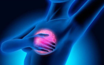 Cancer du sein : dépistage gratuit à partir de 50 ans
