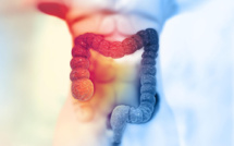 Cancer colorectal : nouvelle campagne d'information à destination des 50-74 ans