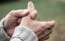 Arthrose du pouce : la maladie du temps perdu