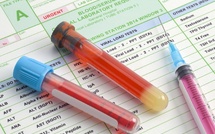 Cancers : les biomarqueurs circulants, un espoir sur tous les fronts