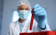 Rajeunir le sang : des chercheurs ont réussi à inverser le vieillissement cellulaire !