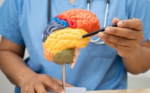 Alzheimer : ce médicament pourrait stopper la maladie avant les premiers symptômes
