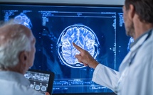 AVC : un seul suffit à faire basculer votre cerveau dans la démence