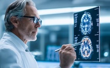 Alzheimer : la France a refusé ces traitements miracles, 20 000 patients étudiés lui donnent raison
