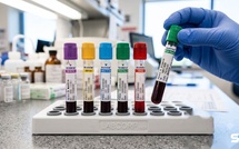 Nés après 1965 : 23 % de vieillissement biologique en plus, un risque de cancer qui grimpe