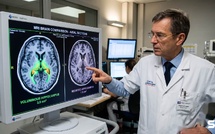 Marche rapide et cerveau : ces octogénaires ont les mêmes lésions qu'Alzheimer mais ne déclinent pas