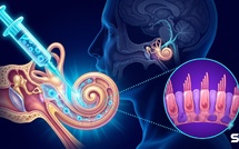 Restaurer l'audition : cette découverte sur les cellules de l'oreille interne change la donne